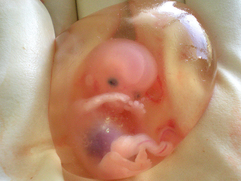 797px-human_fetus_10_weeks_with_amniotic